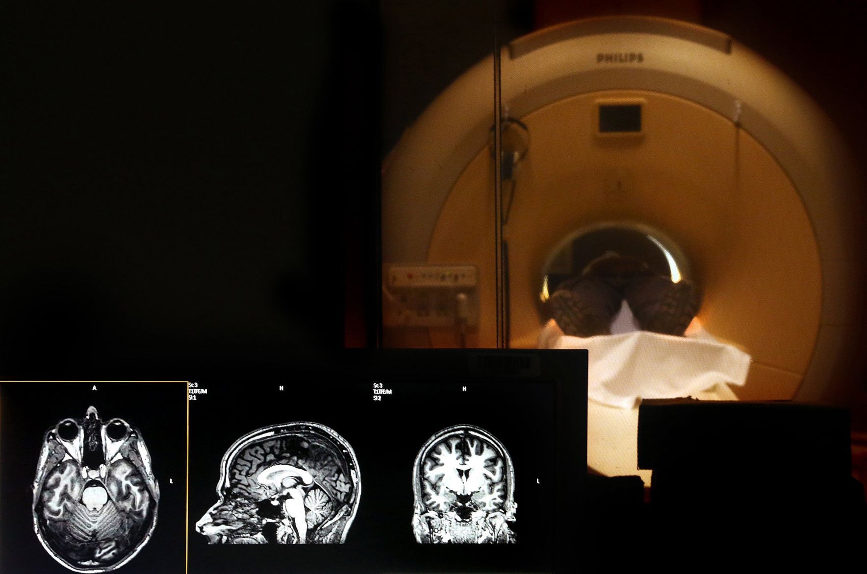 CT scans and MRIs